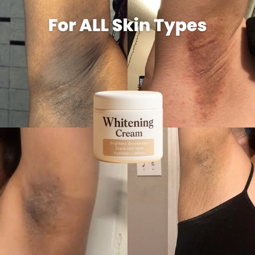 Whitening Cream