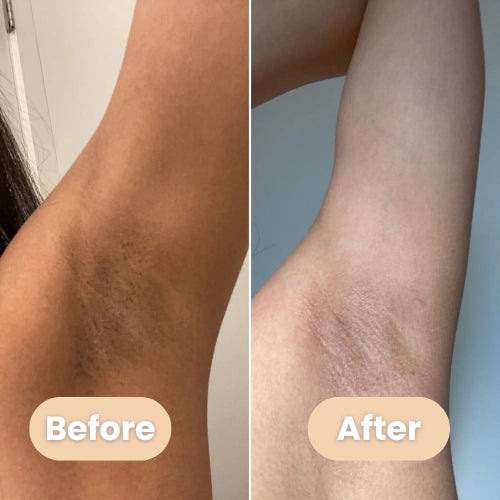 Whitening Cream